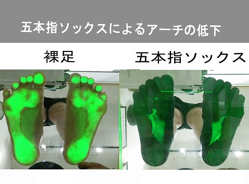 アクリル板上での同一被験者のフットプリント比較。素足状態では足底腱膜の緊張によるアーチが確認できるが、五本指ソックス装着時は趾間の拡幅に伴う代償行為として足底が全接地し、中足骨頭間の横アーチが消失している。