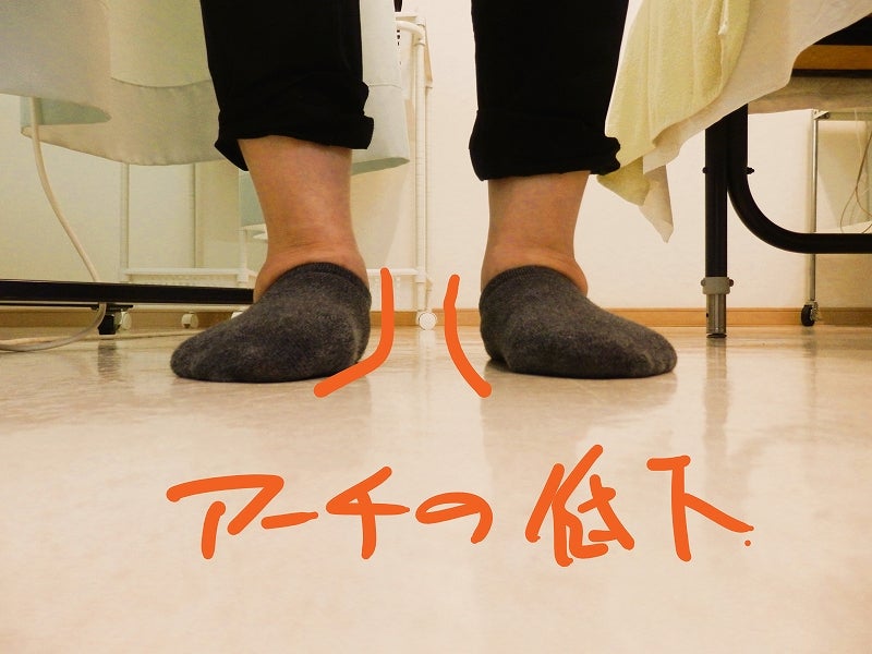 なぜ足のアーチが落ちるのか?│物理で解き明かすアーチ低下のメカニズム