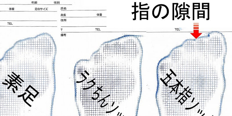 素足、ラクちんソックス、五本指ソックスの足型比較。五本指ソックスでは足指の隙間が広がり、足部アーチ低下が観察される。
