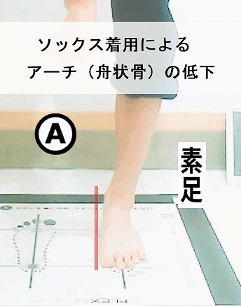 靴下の違いによるアーチの低下を説明する画像