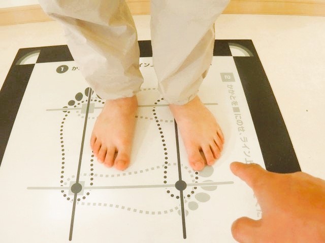 立位で左右のつま先の向きに違いが生じている状態