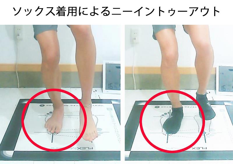 足部アーチが低下し、足首が内側へ移動した結果として、つま先が進行方向より外を向いている状態