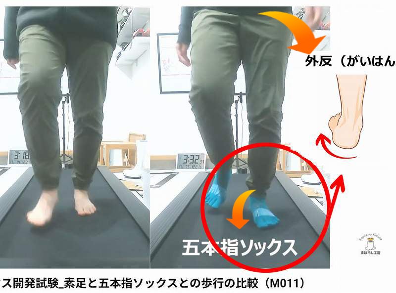 靴下の違いによるアーチの低下、トゥーアウトを説明するがそう