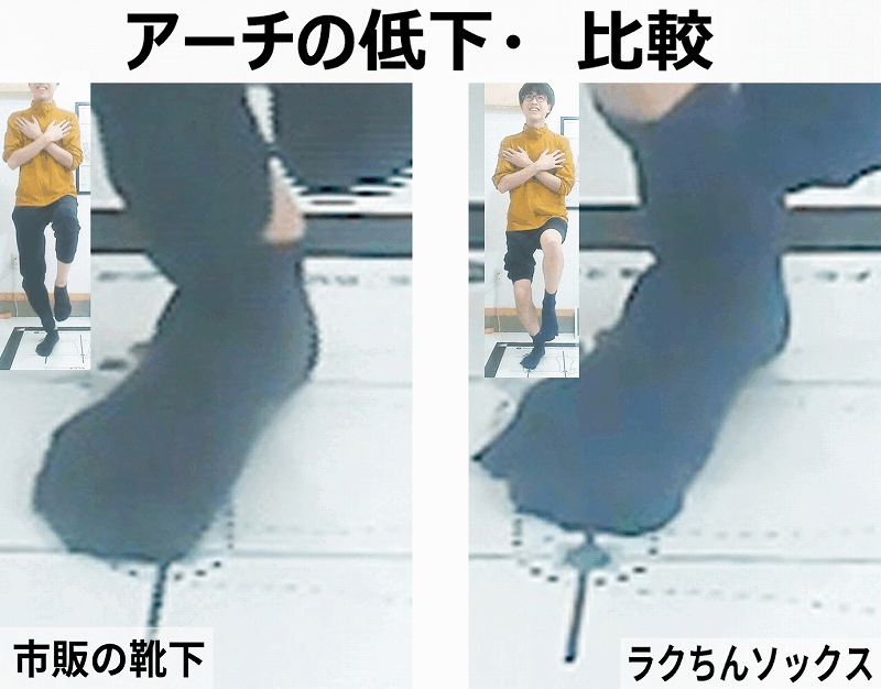 靴下の違いでアーチの低下は変化する様子を説明する画像