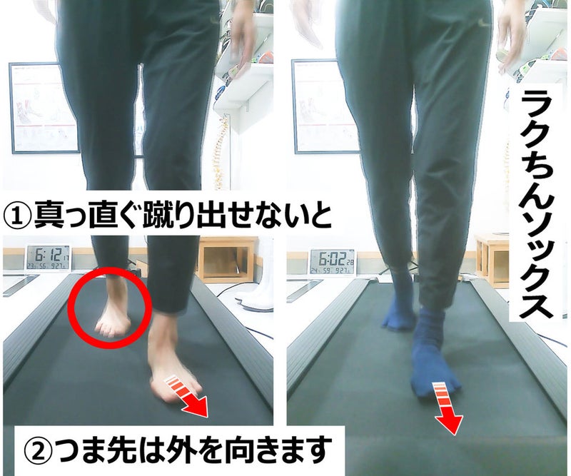 足が地面に着く前から、空中にある足のつま先が外側を向いているトゥアウトの例