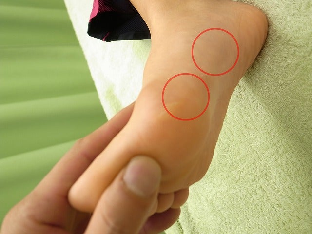 足底腱膜炎で足裏に痛みが出る位置を示した足の画像