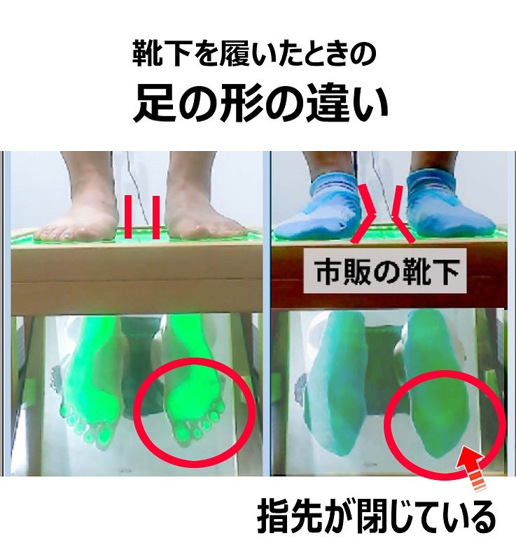 靴下を履くとアーチが落ちた画像