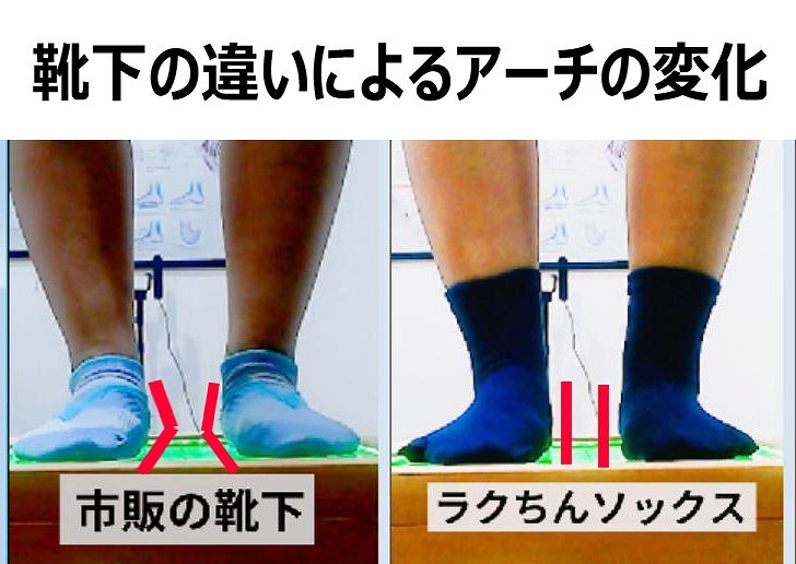 靴下の違いによるアーチの低下の違いを説明する画像
