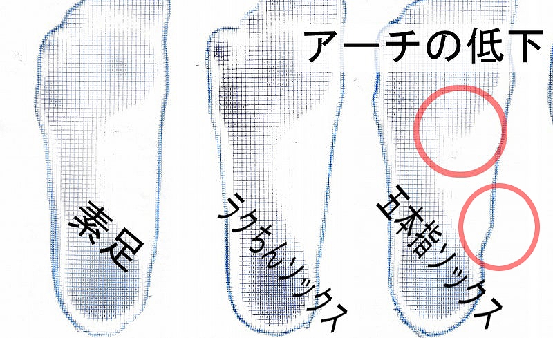 五本指ソックスを履くとアーチが落ちている様子。フットプリント
