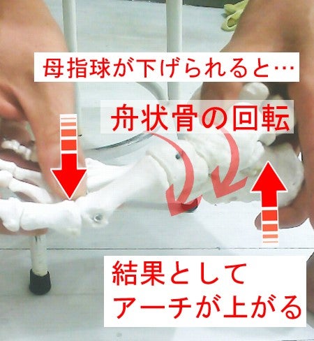 アーチの低下を防ぐ機械的な仕組み