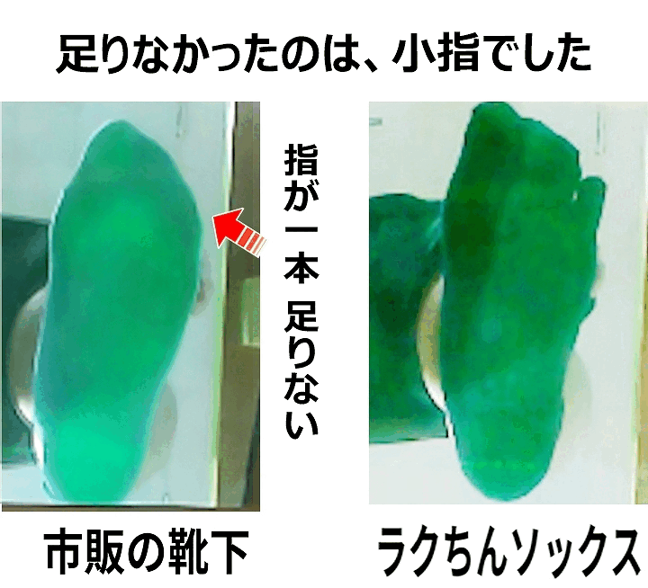 ラクちんソックスと一般的な靴下の違い（内反小趾）