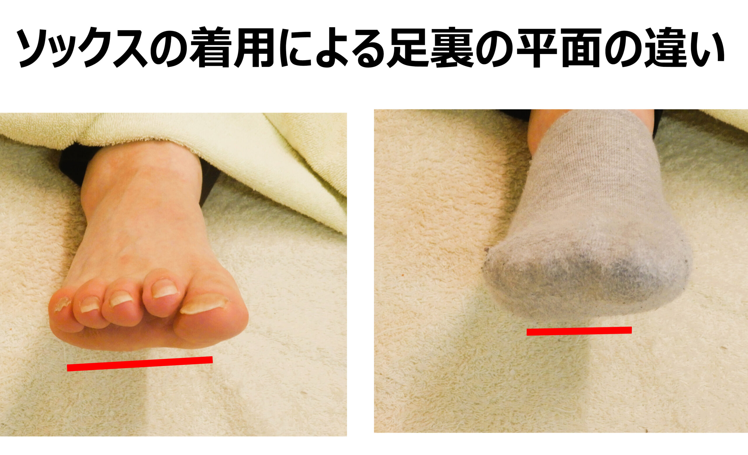 接地面の円形化