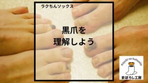 ランニングで黒爪を招く靴下の特徴を解説するまぼろし工房の記事画像