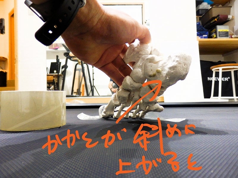踵が斜めに上がり、足部をひとまとまりに固めにくくなっている状態