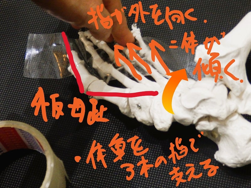 ヒールリフト時に足指が静止時よりも大きく前方へ伸びている比較画像