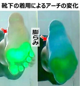 症例107│ソックス着用による内側アーチの膨隆を観察した 素足とソックス着用でのアーチの膨らみの違い。ソックスを履くとアーチに膨らみが観測できた様子