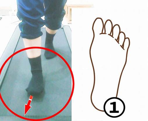 歩き始めに、前へ出した足のつま先が少し外を向いている様子