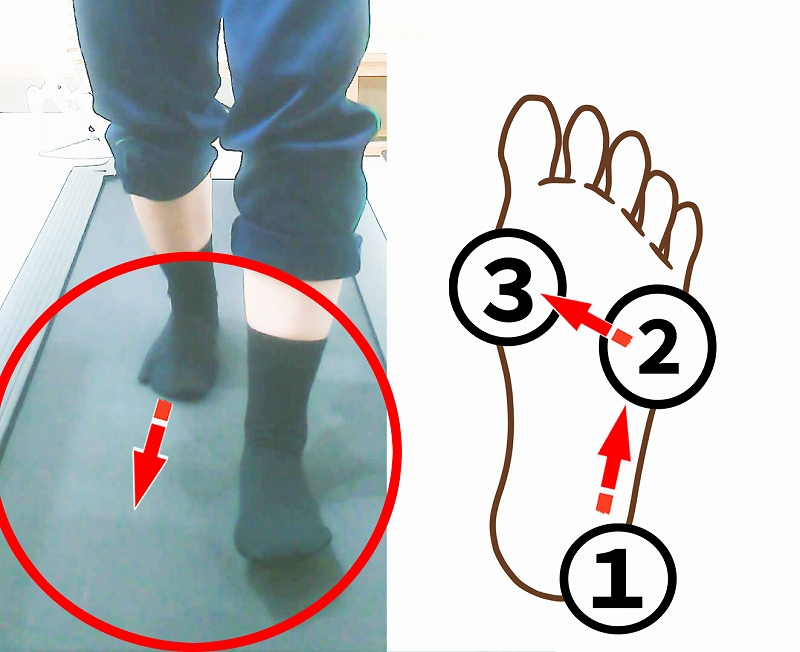 歩行中に小指側から母指球へ荷重が移動する足裏の動き