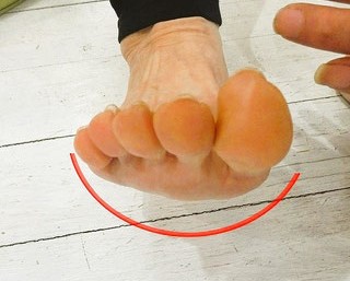タコや魚の目の改善には足裏の圧力を分散することが大切