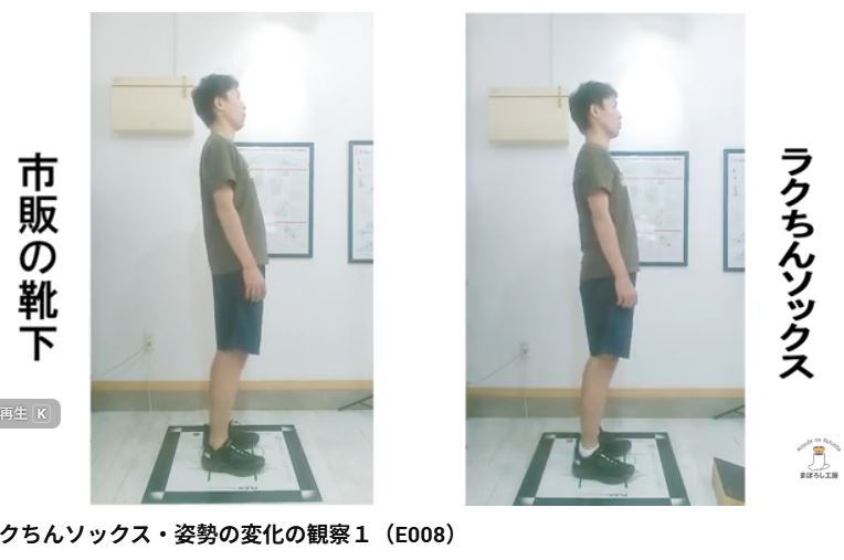 ラクちんソックスと一般的な靴下での立位の比較。ラクちんソックスを履くと、背中のアーチバックが改善している様子