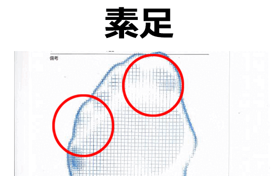 素足状態と一般的な丸型靴下着用時におけるフットプリント（足圧・接地形状）の比較データ。靴下の緊迫力による第1趾・第5趾の強制的な内転（狭窄）の可視化。