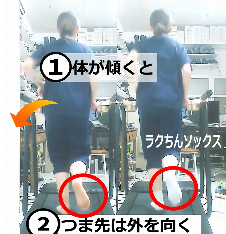 ランニング中の跳ね上げるつま先の向きが外側に向いている状態と、正常な状態をしめしている
