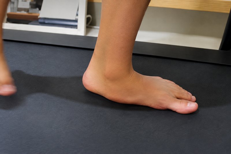 足首内側の腫れ痛み│後脛骨筋不全