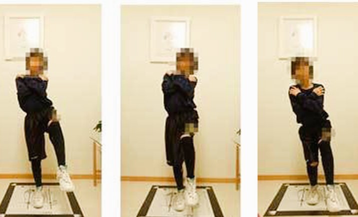 オーダーメイドインソールを入れたバスケットシューズで片足立ちを行い身体の傾きが大きくなった比較画像