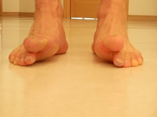 リハビリテーション