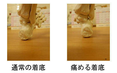 体幹、骨盤、膝、足首の動きによって、歩行時に踵が地面へ着く位置と角度が変化する様子を示した画像