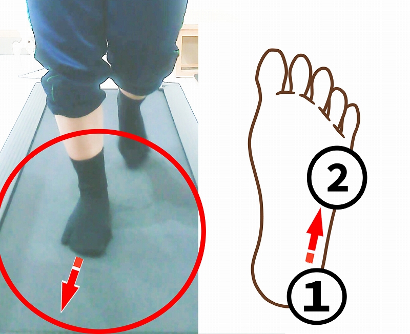 足を少し外向きに出し、足裏の外側から小指側で体重を受けている歩行中の様子を示した写真