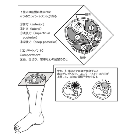 下腿を前方・側方・浅後方・深後方の四つのコンパートメントに分け、各区画の位置を示した図