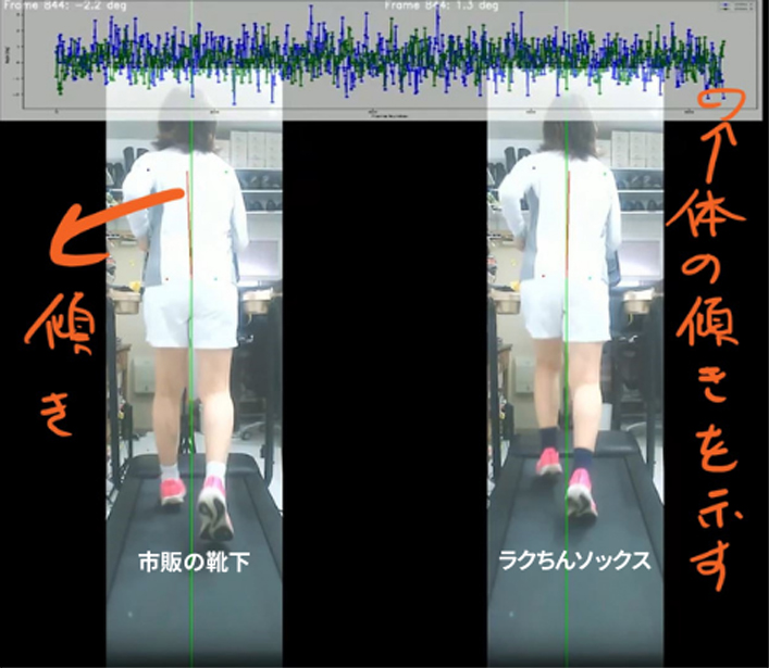 一般的な靴下とラクちんソックスで走行時の身体の左右へのグラつきと姿勢を比較した画像