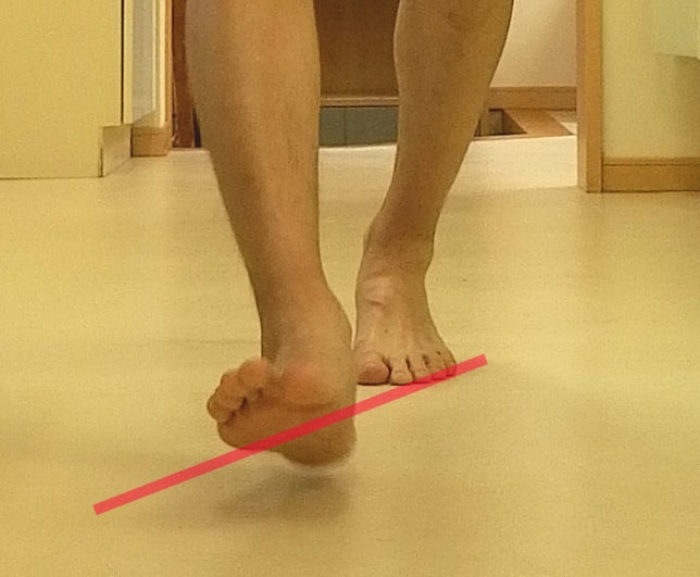 歩行時に踵骨の尖った部分を避け、少し外側にある面から地面へ接地する位置を示した踵の骨格画像