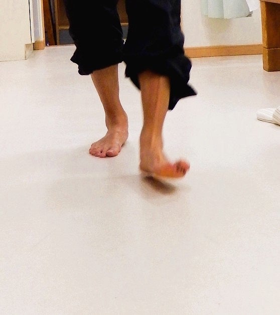 荷重によって下がった足の構造が、条件が変わったあとも元の状態へ戻りにくくなった様子を示した画像