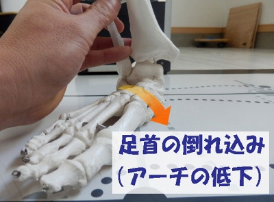 荷重を受けたときに舟状骨が床へ近づき、足の内側にある縦アーチが一時的に低下する様子を示した画像