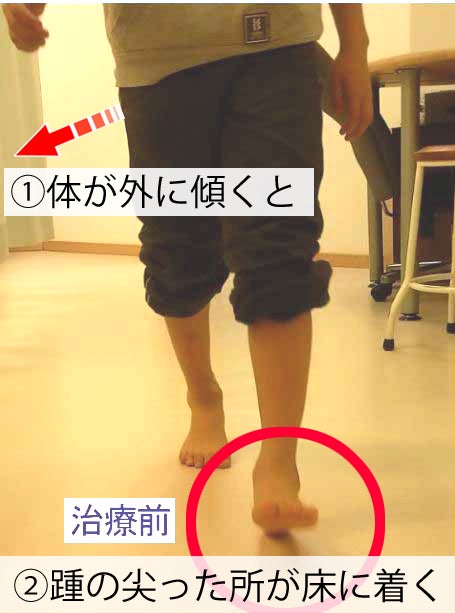 反対側の足で蹴り出したときに身体が外側へ傾き、前方へ運ばれた足の踵が尖った部分から接地する流れを示した画像