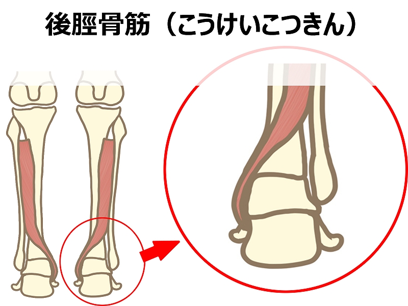 足の内側からスネへ向かって走る後脛骨筋の位置を示した図