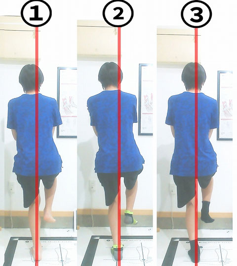 腕振りの左右差を確認する前に、片足立ちで体幹、骨盤、膝、足首の傾きを観察している画像