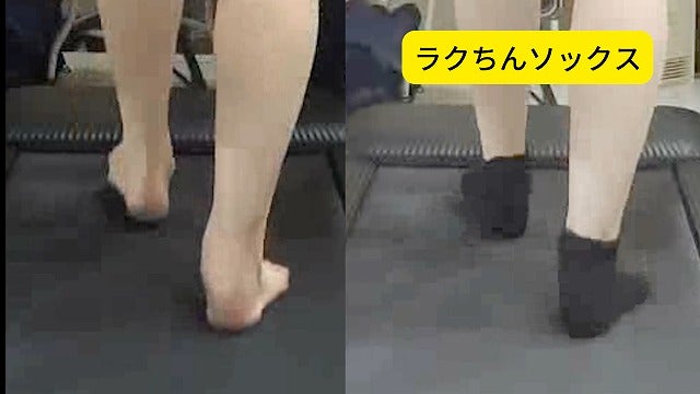足部骨格の連動によって、舟状骨と内側縦アーチの位置が変化する仕組みを示した補足図
