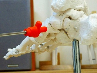 足の内側から舟状骨の位置を確認した写真。内くるぶしの前方、土踏まずの上にある出っ張りを示しています