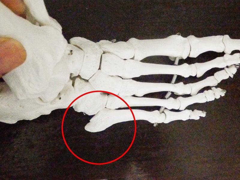 小指側にある第5中足骨の外側の突起を示した足部骨格図。床からの反力を受ける位置を確認できます