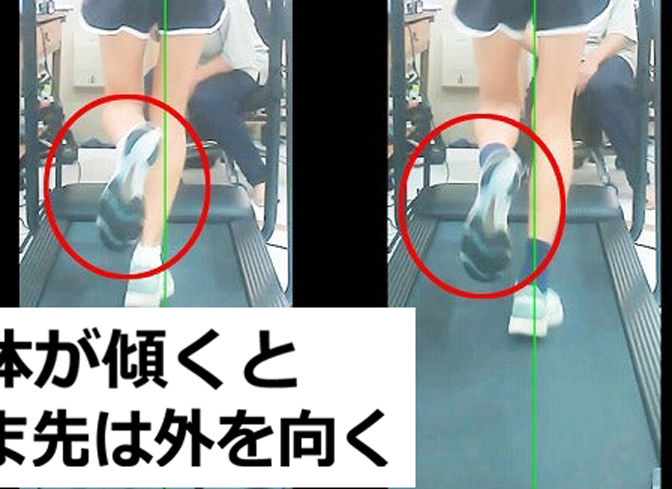 後方へ跳ね上げた足を拡大し、つま先が外側を向いている状態と前方を向いている状態を比較した画像
