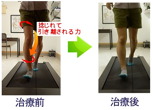 膝の内側を軽く触れて痛みの場所を確認し、強い圧痛や腫れがある場合の受診判断を示した画像