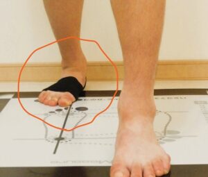 つま先を外へ向けたアキレス腱ストレッチで足裏にねじれと牽引力が加わる様子
