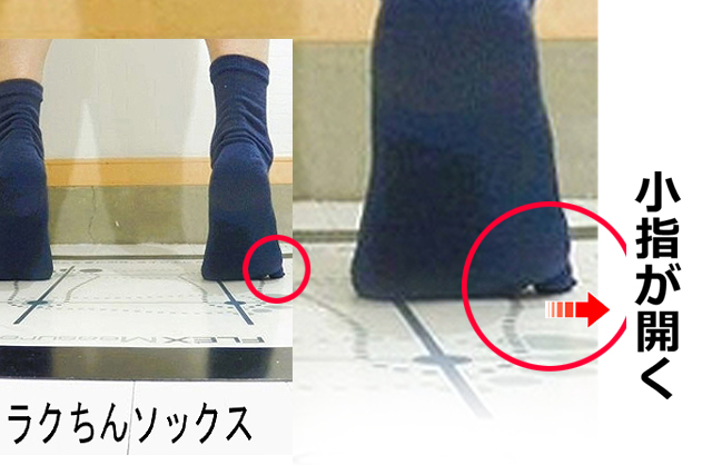 足の小指が使いやすくなったときの、立ち方や身体の安定性の変化を示す画像