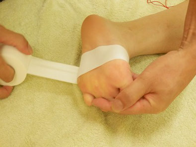 薬指と小指を軽く下げた状態で、足裏の横アーチに沿って小指の外側までテープを貼った写真