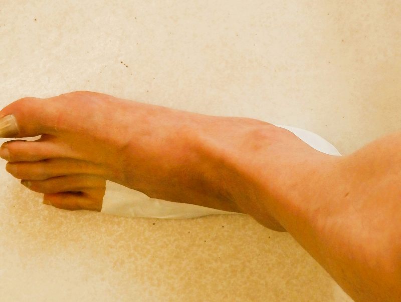 足底腱膜炎のテーピングが完成した足裏の状態
