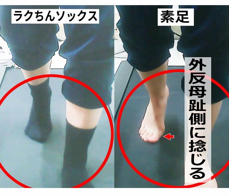 素足とラクちんソックス着用時における足指の向きと使われ方の比較
