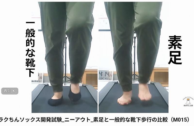 素足で歩いたときの正面から見た足首とアーチの状態